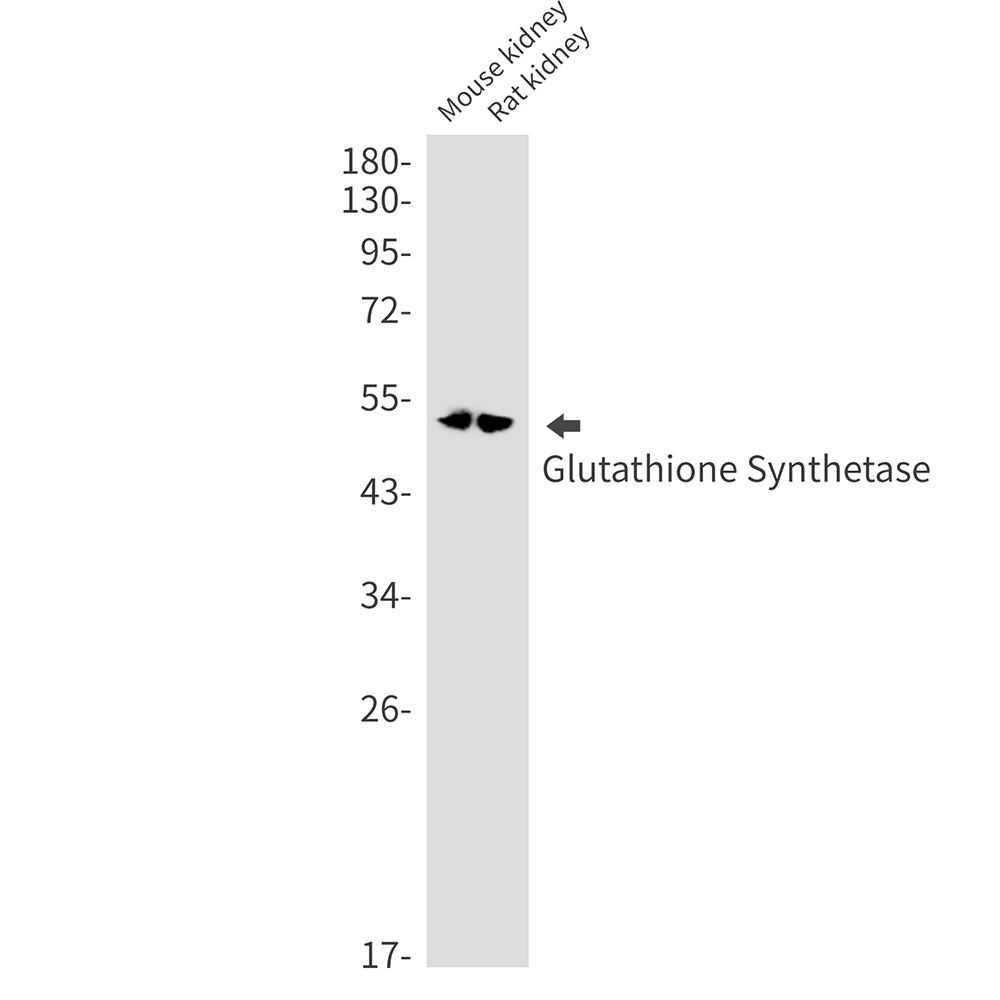 Anti-Glutathione Synthetase Rabbit mAb [36M80L40]