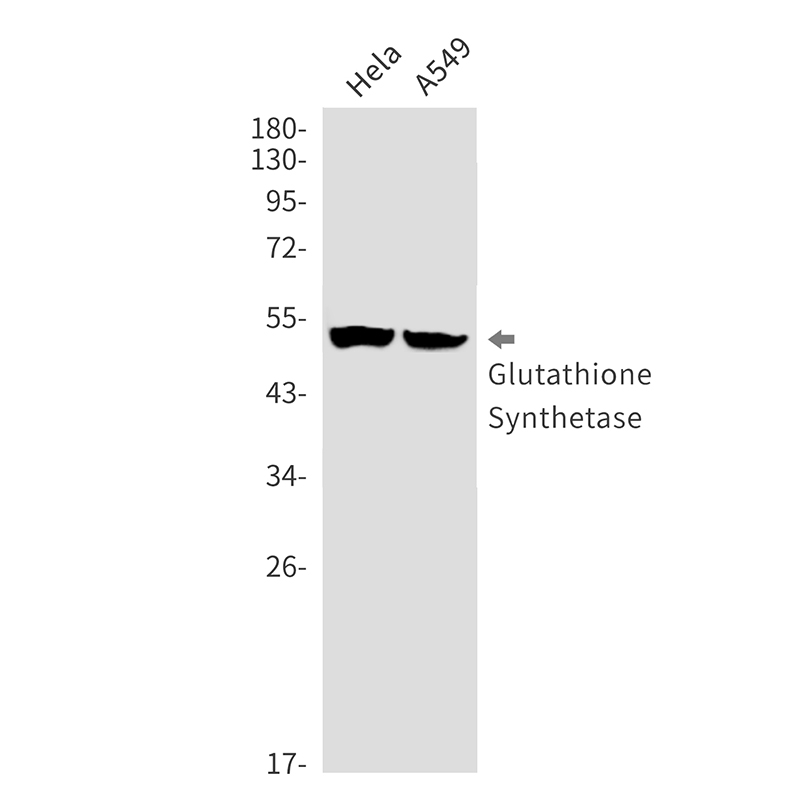 Anti-Glutathione Synthetase Rabbit mAb [36M80L40]