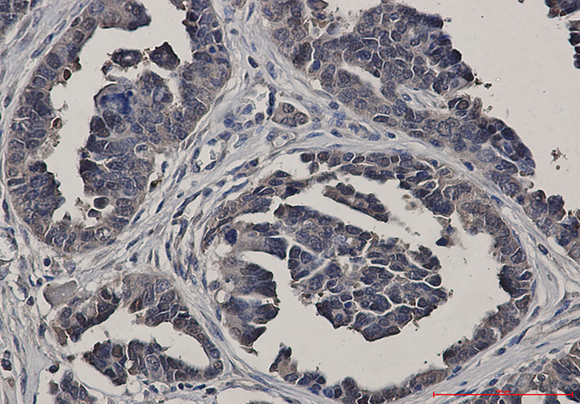 Anti-Glutathione Synthetase Rabbit mAb [36M80L40]