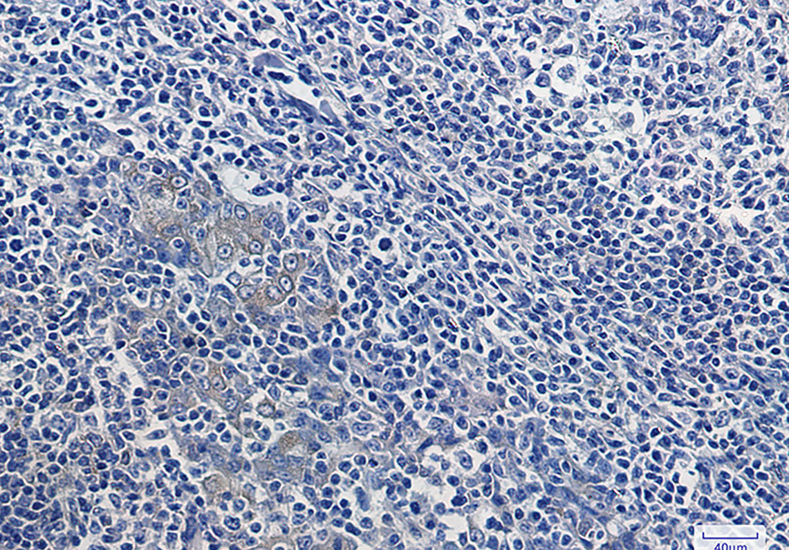 Anti-IKB alpha Rabbit mAb [46K76M90]