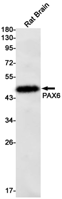 Anti-PAX6 Rabbit mAb [50K97K38]