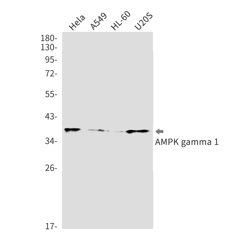 Anti-AMPK gamma 1 Rabbit mAb [45K75K29]