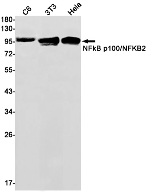 Anti-NF-KB p100 Rabbit mAb [78L90K66]
