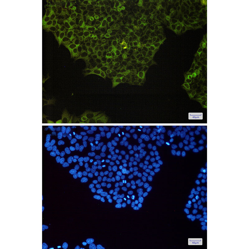 Anti-NF-KB p100 Rabbit mAb [78L90K66]