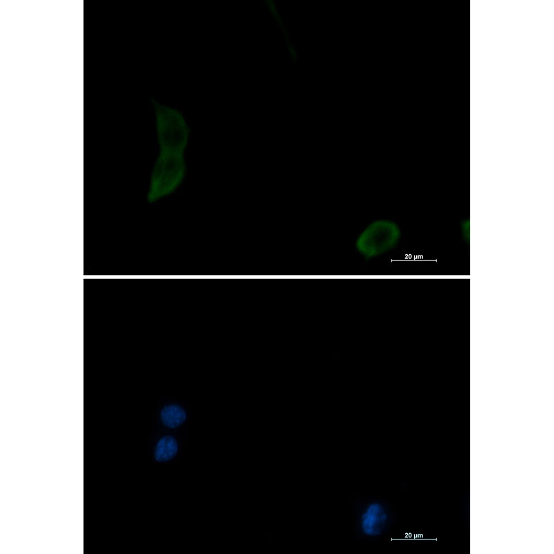 Anti-PAK1 Rabbit mAb [28K90M22]