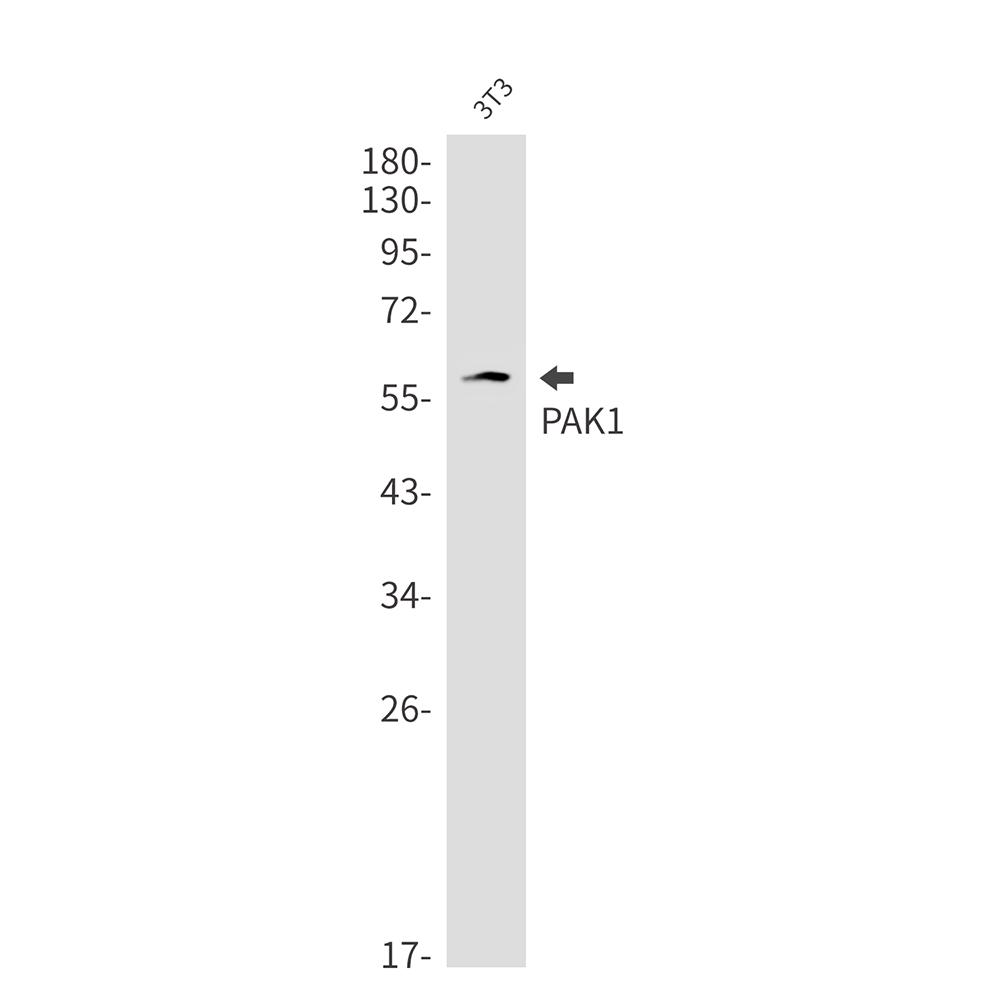 Anti-PAK1 Rabbit mAb [28K90M22]