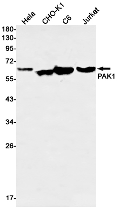 Anti-PAK1 Rabbit mAb [28K90M22]