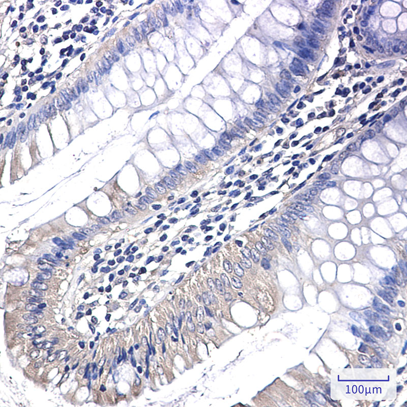 Anti-PAK1 Rabbit mAb [28K90M22]