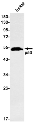 Anti-p53 Rabbit mAb [12K17M78]