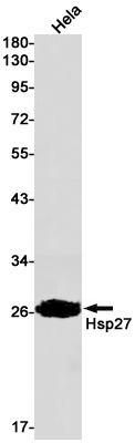 Anti-Hsp27 Rabbit mAb [92K84M37]