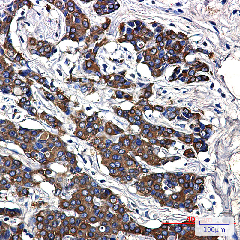 Anti-Hsp27 Rabbit mAb [92K84M37]