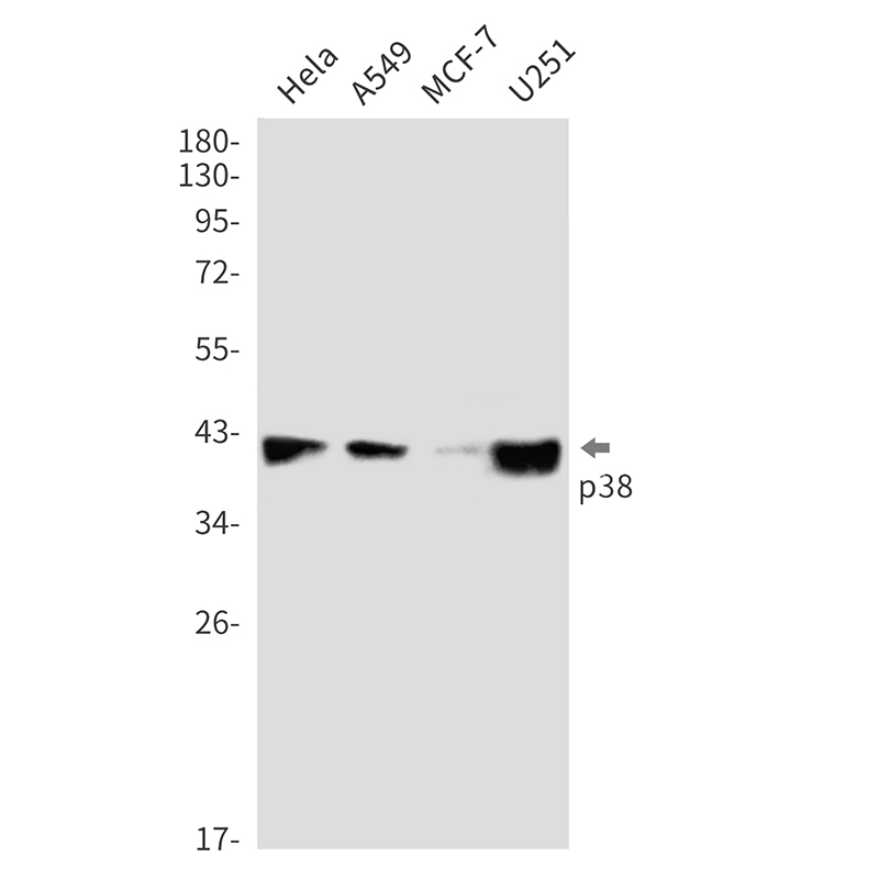 Anti-p38 Rabbit mAb [95M58K12]