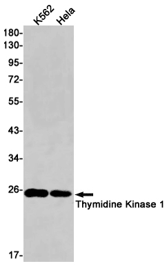 Anti-Thymidine Kinase Rabbit mAb [69L11M27]