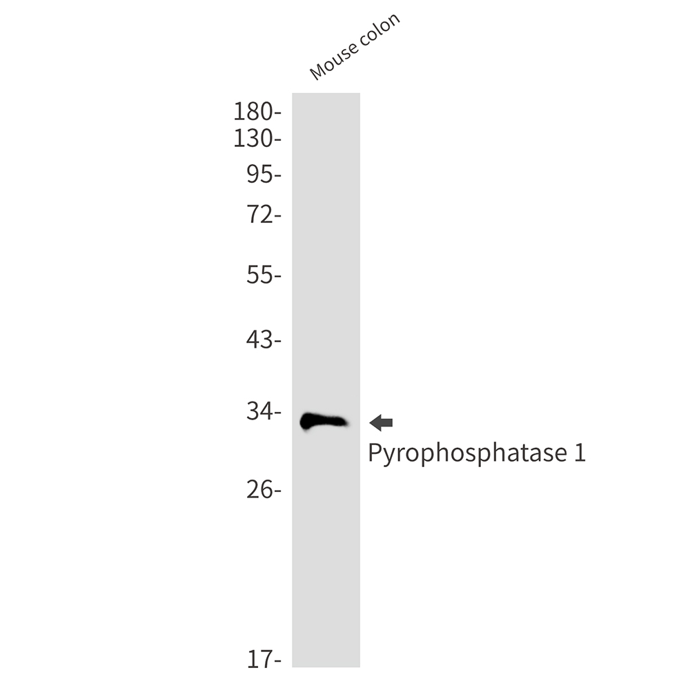 Anti-Pyrophosphatase 1 Rabbit mAb [77K34L11]