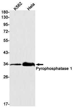 Anti-Pyrophosphatase 1 Rabbit mAb [77K34L11]