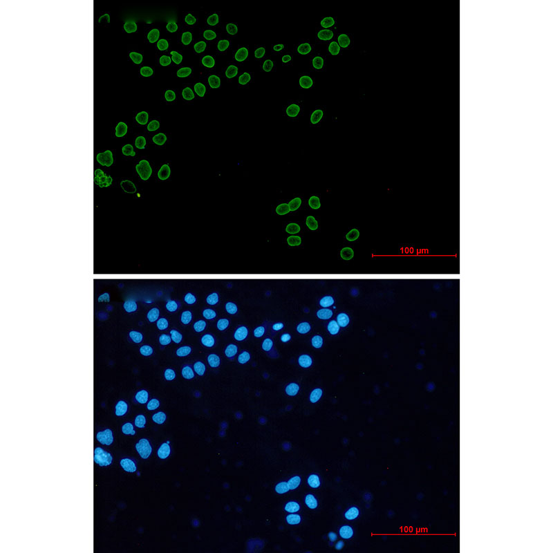 Anti-Lamin A/C Rabbit mAb [69M64L52]