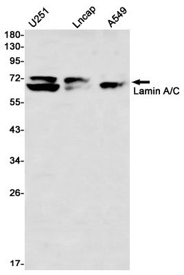 Anti-Lamin A/C Rabbit mAb [69M64L52]