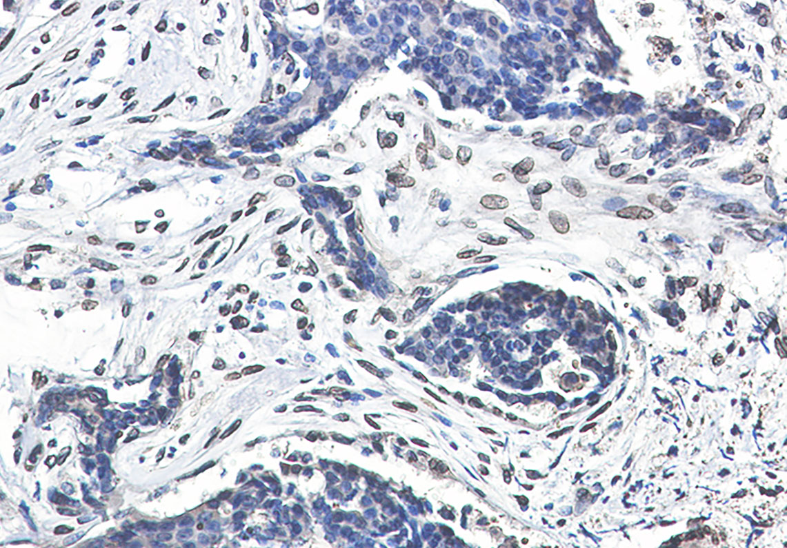 Anti-Lamin A/C Rabbit mAb [69M64L52]