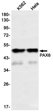 Anti-PAX6 Rabbit mAb [85L10K39]