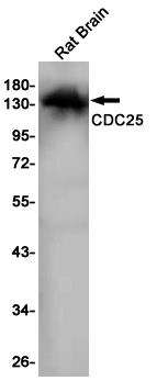 Anti-CDC25 Rabbit mAb [98L88L09]