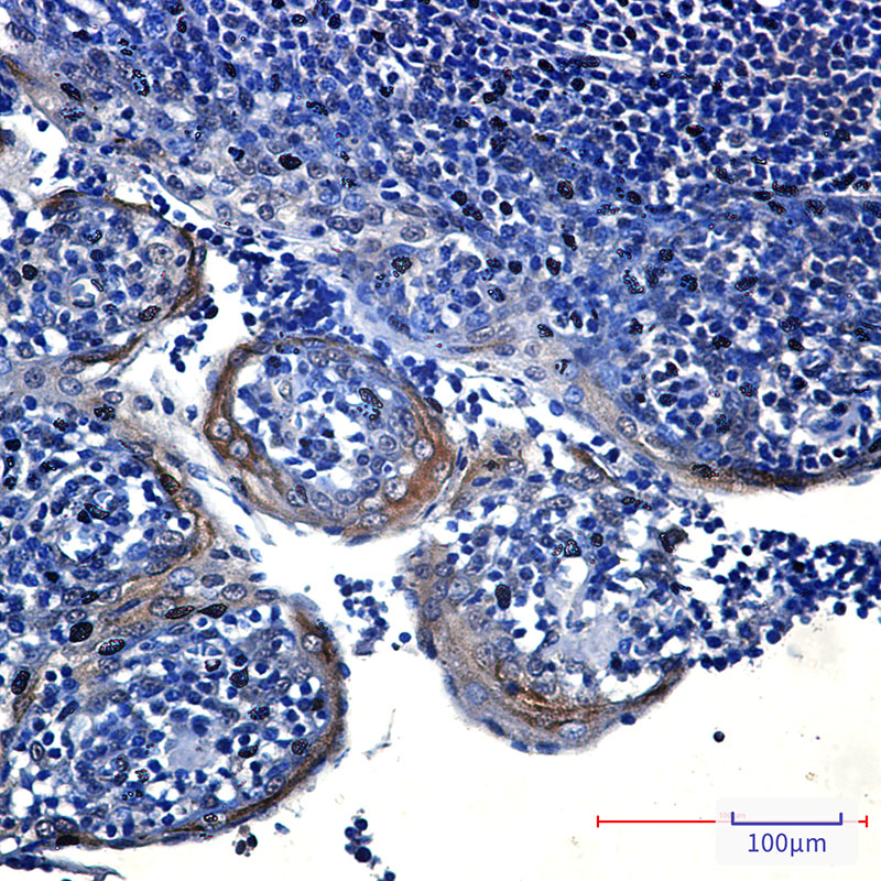 Anti-eIF4A3 Rabbit mAb [25L73M36]