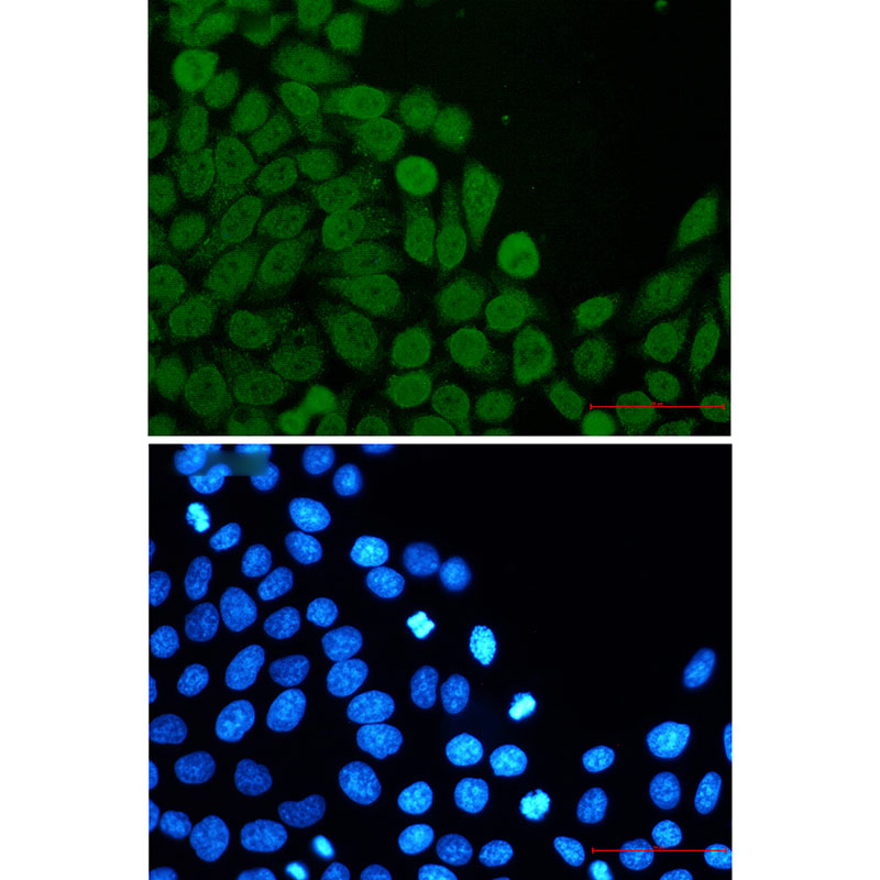 Anti-eIF4A3 Rabbit mAb [25L73M36]