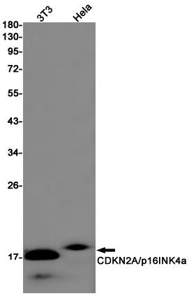 Anti-CDKN2A/p16INK4a Rabbit mAb [47L65M96]