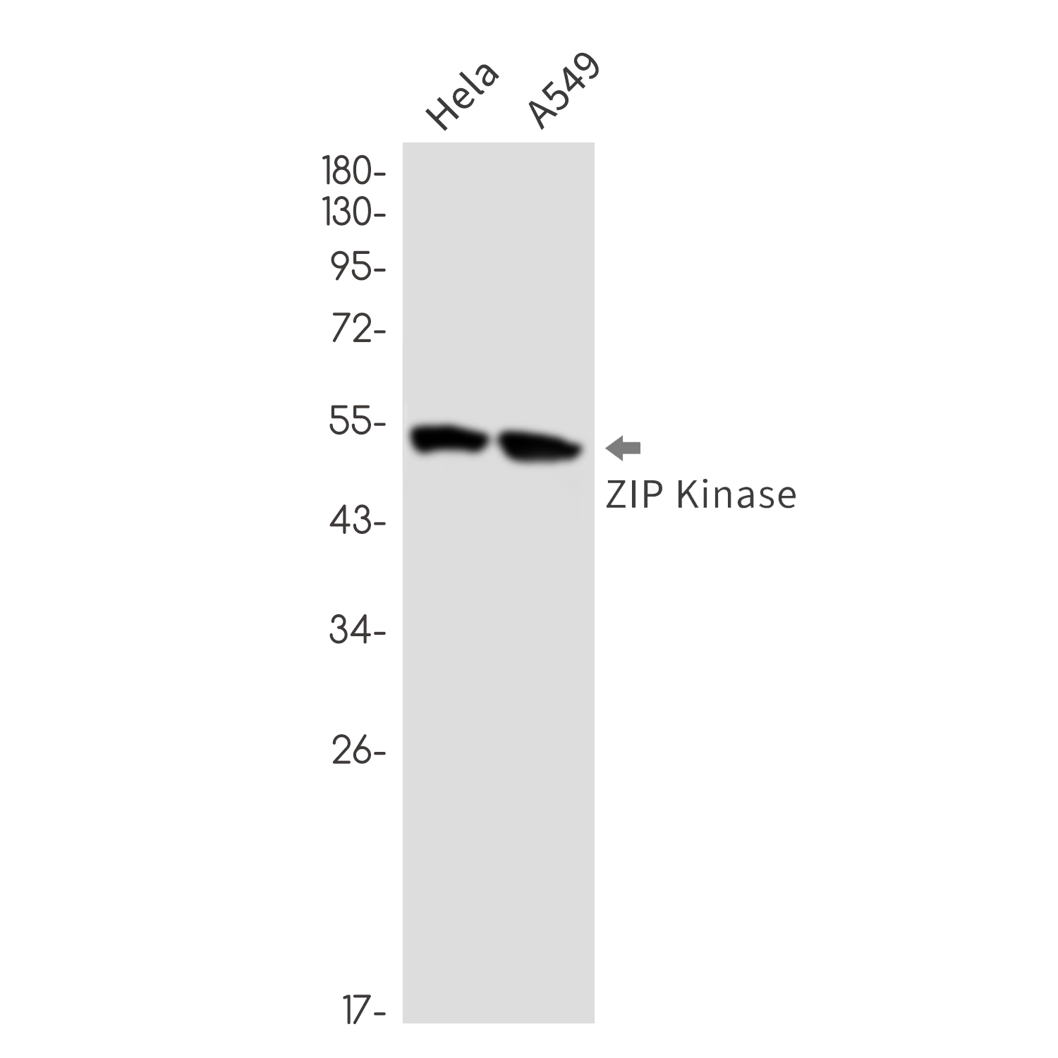 Anti-DAP kinase 3 Rabbit mAb [27K90K37]