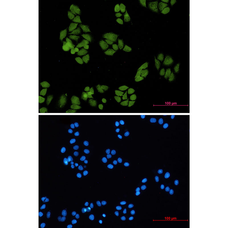 Anti-Smad4 Rabbit mAb [44L41L23]