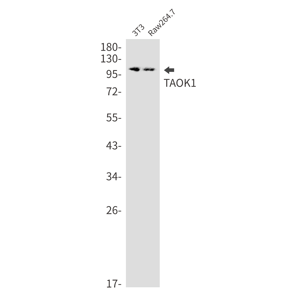Anti-TAOK1 Rabbit mAb [13M64K38]