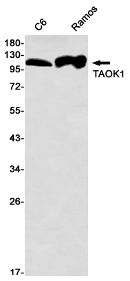 Anti-TAOK1 Rabbit mAb [13M64K38]