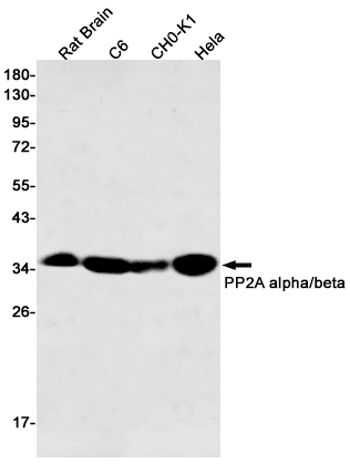 Anti-PP2A alpha/beta Rabbit mAb [68K98L03]