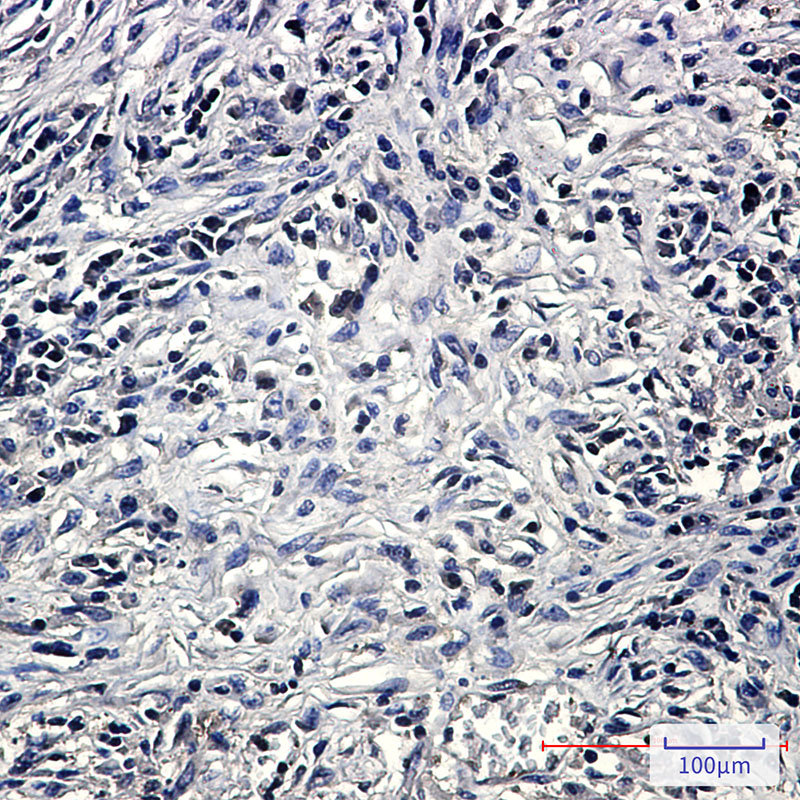 Anti-PP2A alpha/beta Rabbit mAb [68K98L03]