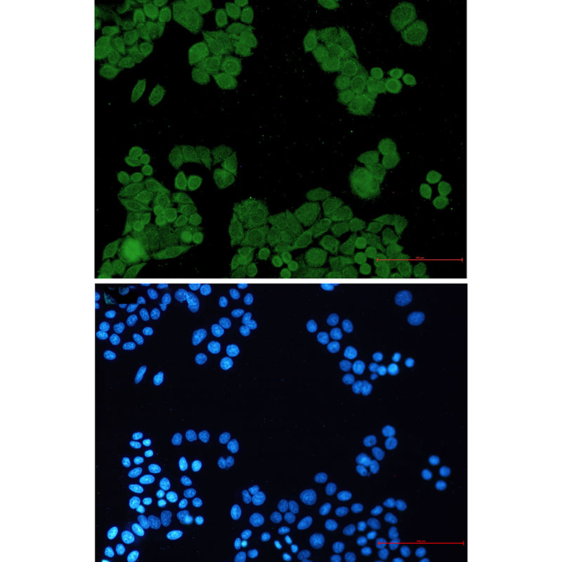 Anti-PP2A alpha/beta Rabbit mAb [68K98L03]