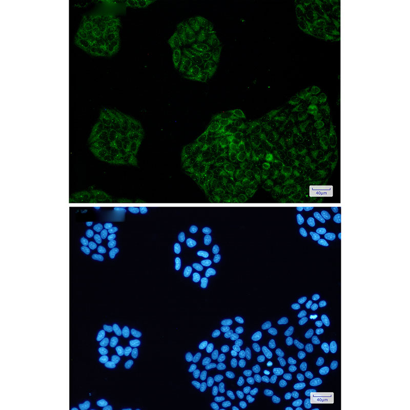 Anti-Amyloid Precursor Protein Rabbit mAb [43L53M98]