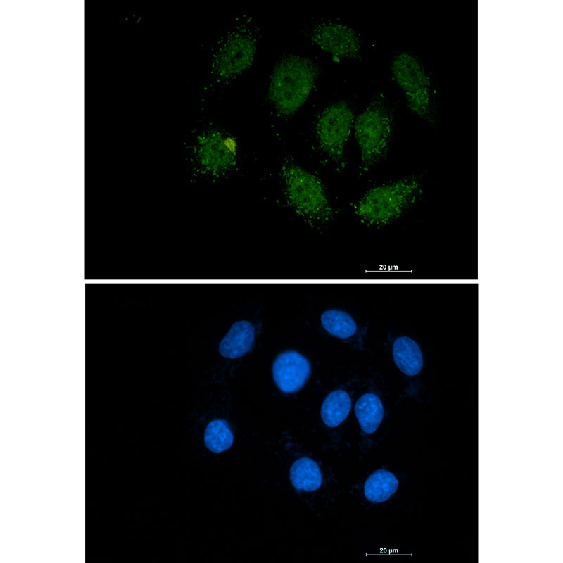 Anti-Smad3 Rabbit mAb [19K90K45]