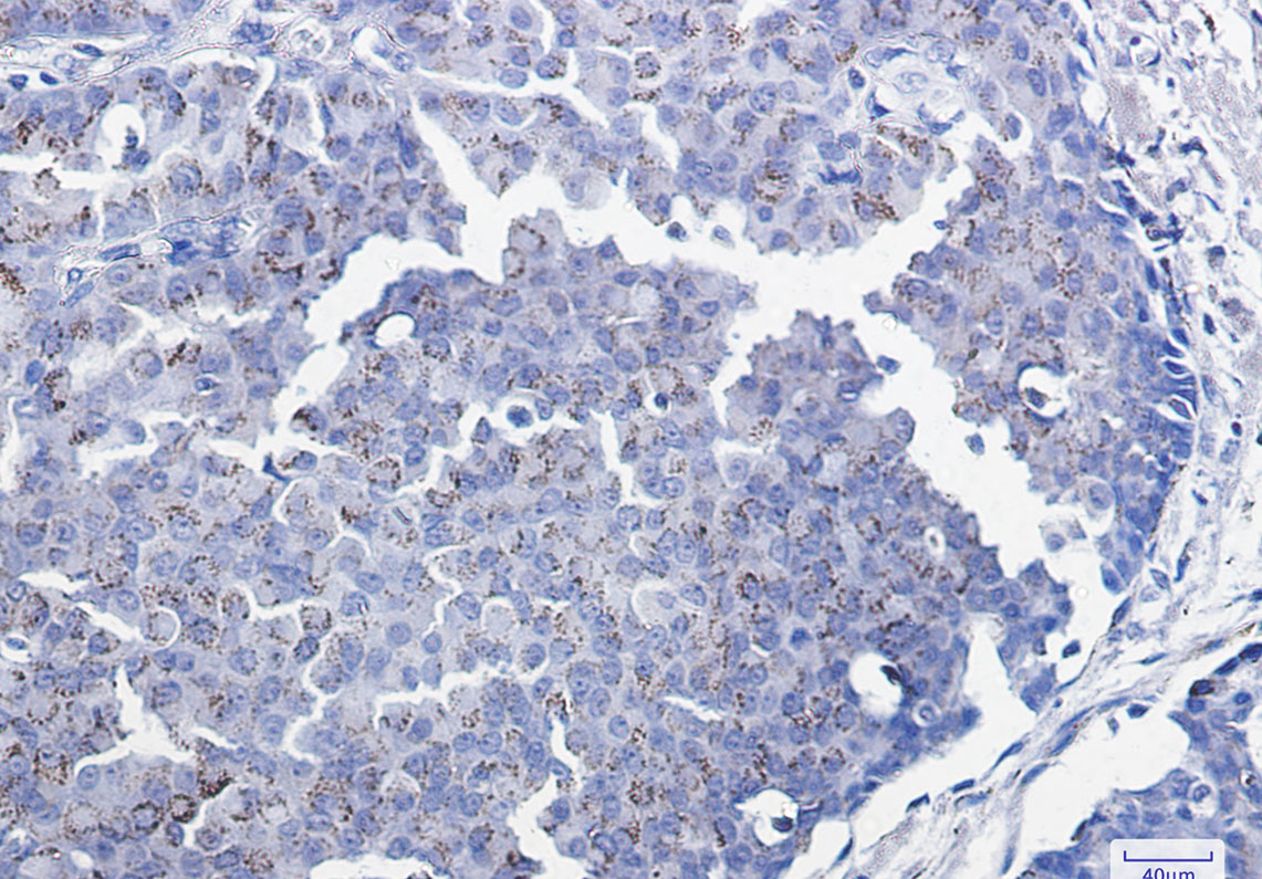 Anti-Smad3 Rabbit mAb [19K90K45]