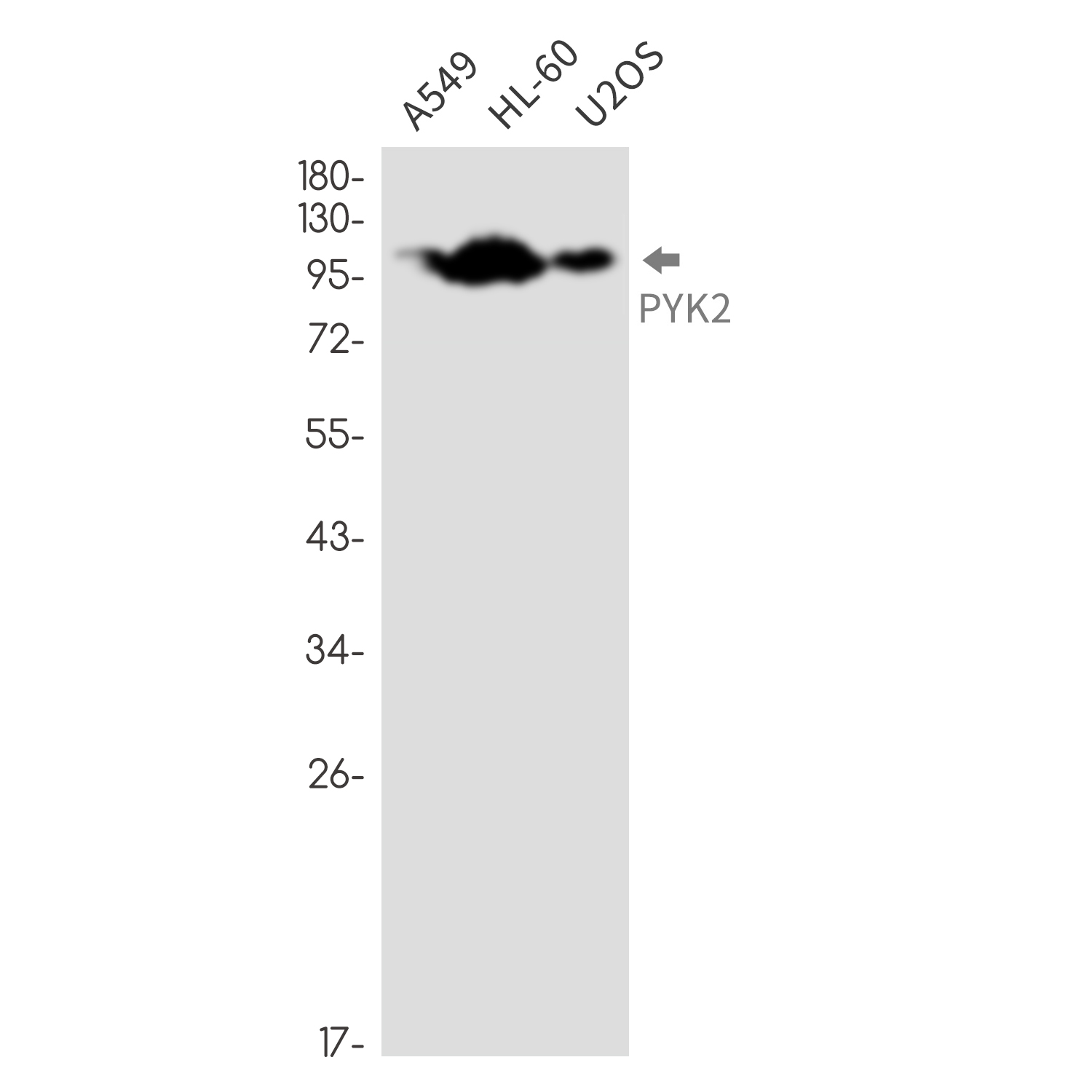 Anti-PYK2 Rabbit mAb [76L19L68]