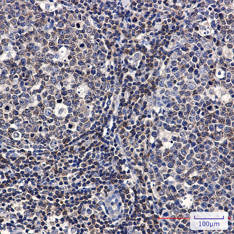 Anti-PYK2 Rabbit mAb [76L19L68]