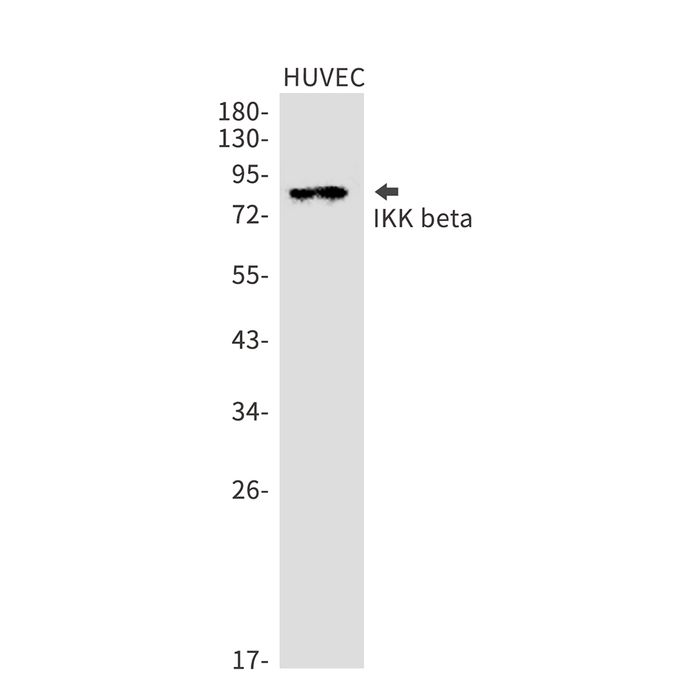 Anti-IKK beta Rabbit mAb [35L73K13]