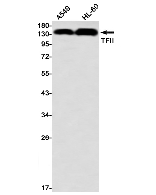 Anti-TFII I Rabbit mAb [66M61K15]