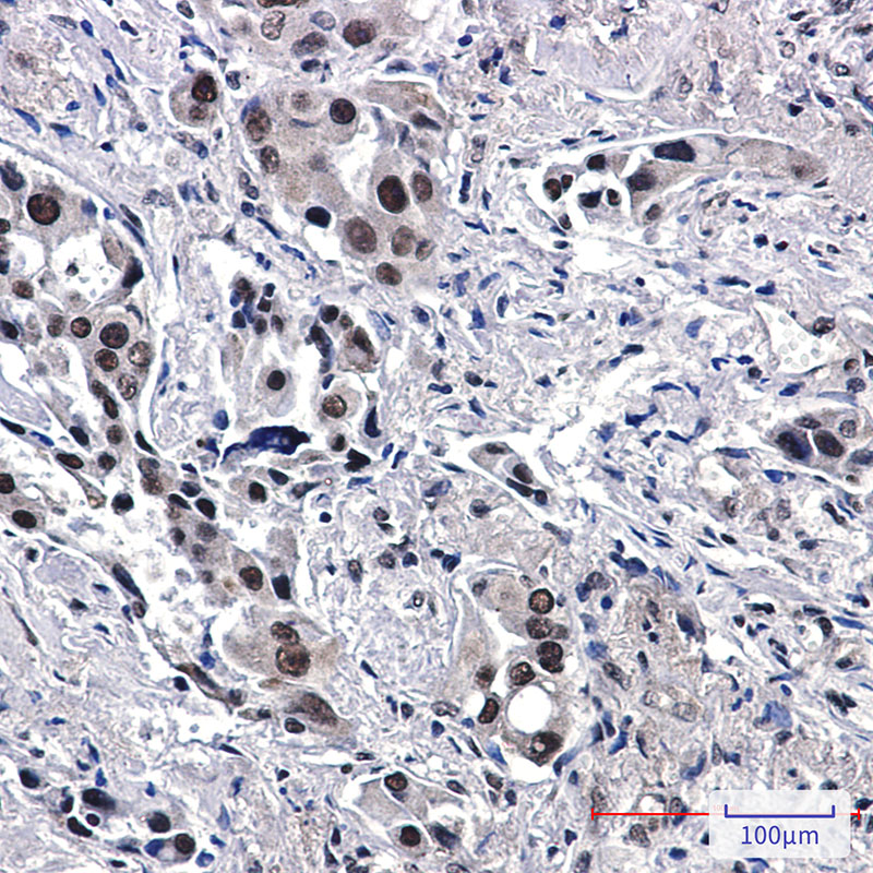 Anti-TFII I Rabbit mAb [66M61K15]