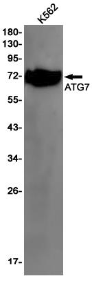 Anti-ATG7 Rabbit mAb [88K57K10]