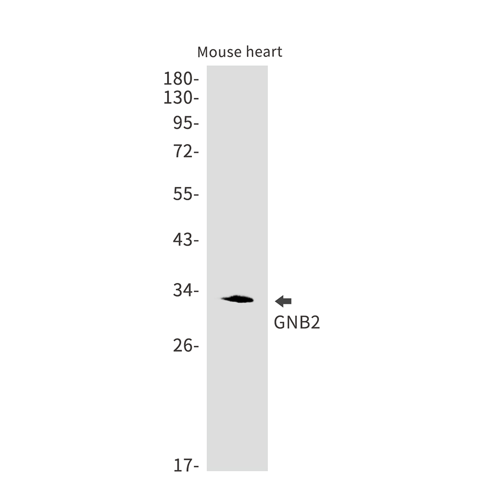 Anti-GNB2 Rabbit mAb [44M71L28]