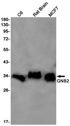 Anti-GNB2 Rabbit mAb [44M71L28]