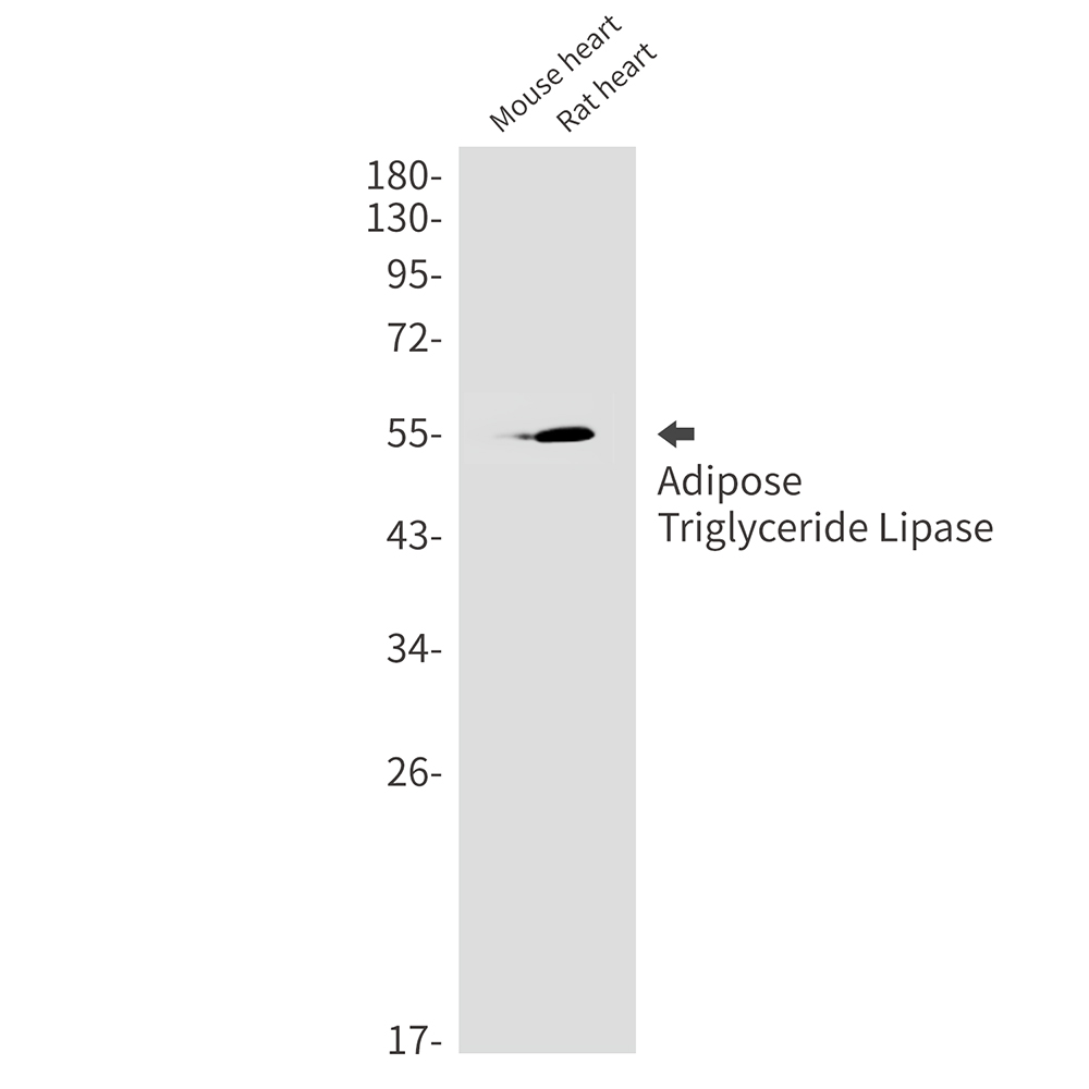 Anti-Adipose Triglyceride Lipase Rabbit mAb [74L49L28]