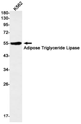 Anti-Adipose Triglyceride Lipase Rabbit mAb [74L49L28]