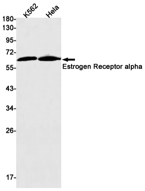 Anti-Estrogen Receptor alpha Rabbit mAb [85K85L37]