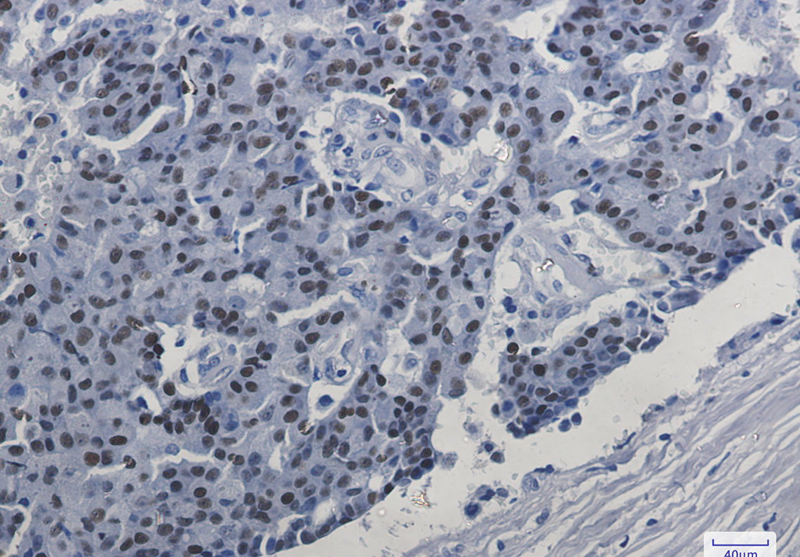 Anti-Estrogen Receptor alpha Rabbit mAb [85K85L37]