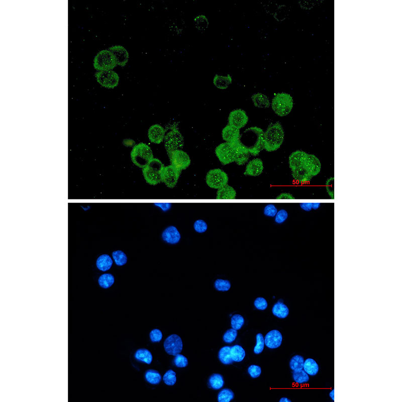 Anti-Estrogen Receptor alpha Rabbit mAb [85K85L37]